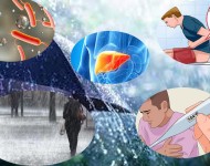 मनसुनमा टाइफाइडदेखि डेंगुसम्मको जोखिम, लक्षण र बच्ने उपाय